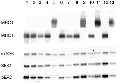 mTORC1 Signaling in Individual Human Muscle Fibers Following Resistance Exercise in Combination With Intake of Essential Amino Acids